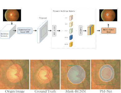 PM-NET: Pyramid Multi-Label Network for Optic Disc and Cup Segmentation