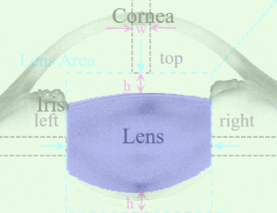 An Efficient Lens Structures Segmentation Method on AS-OCT Images