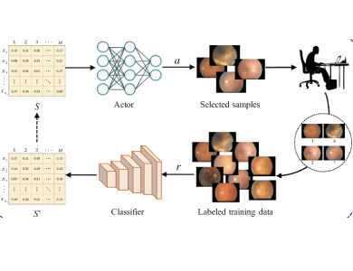 Deep Reinforcement Active Learning for Medical Image Classification